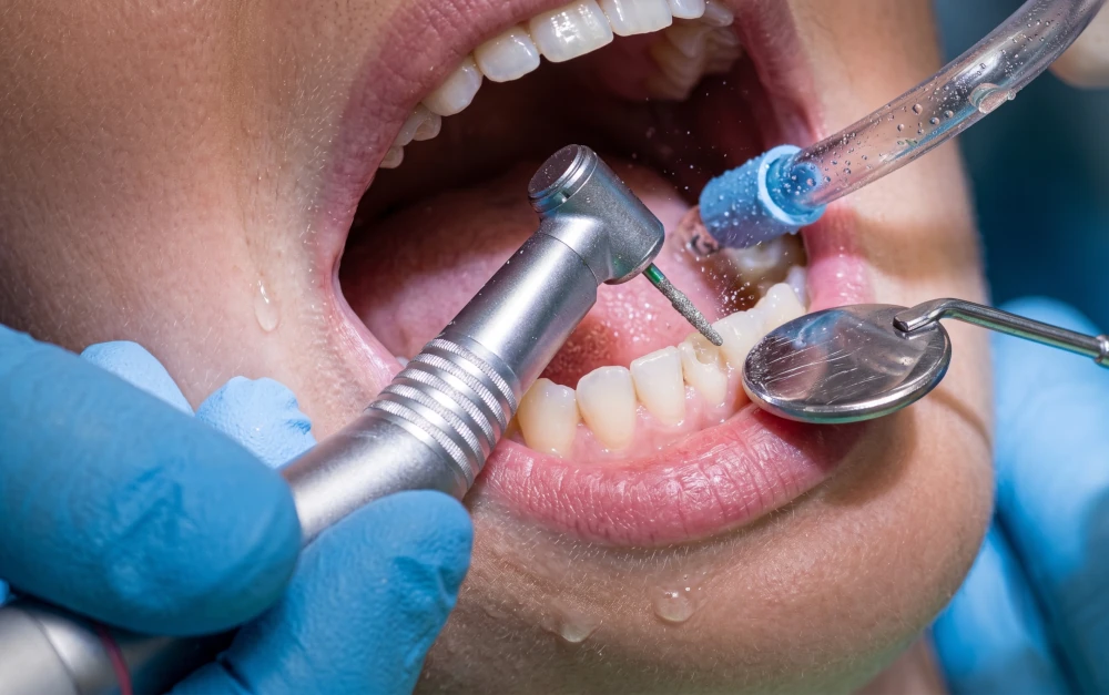 Cirurgia Oral