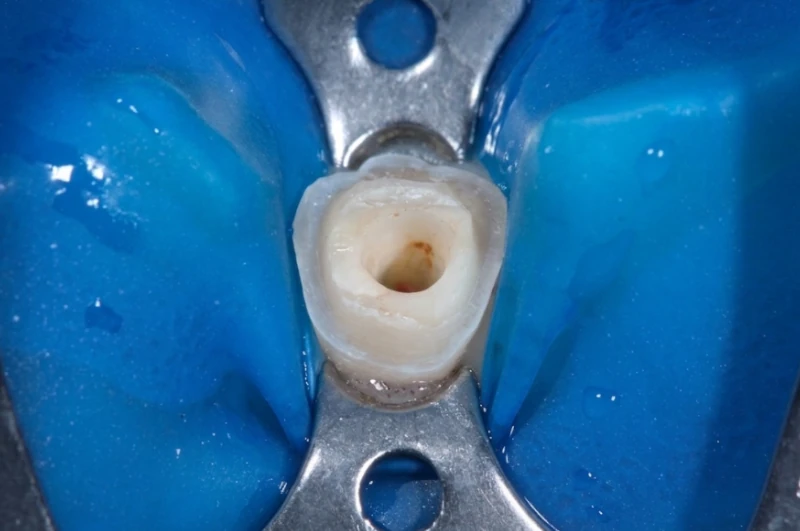Endodontia